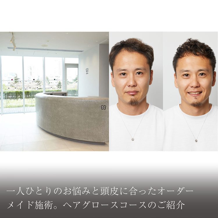 一人ひとりのお悩みと頭皮に合ったオーダーメイド施術。ヘアグロースコースのご紹介画像