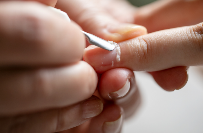 メソッド2:取り去る_1