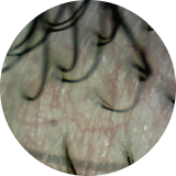 赤み（血行不良）・薄毛・抜け毛